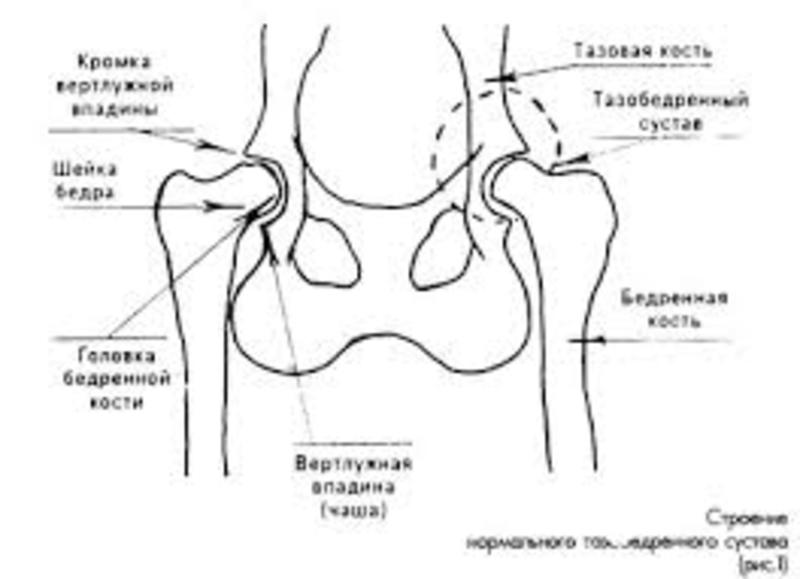 Строение тазобедренного сустава у ребёнка Строение тазобедренного сустава у ребёнка